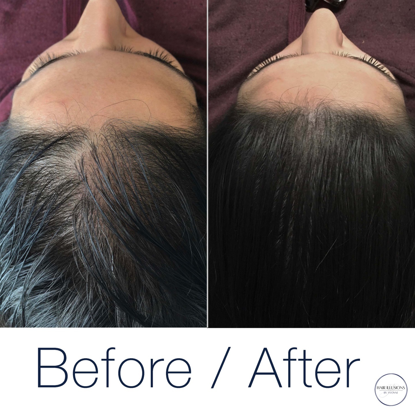 It's amazing to see the huge difference that SMP can have on my female clients. Just proof that this procedure is not only for men, and shav