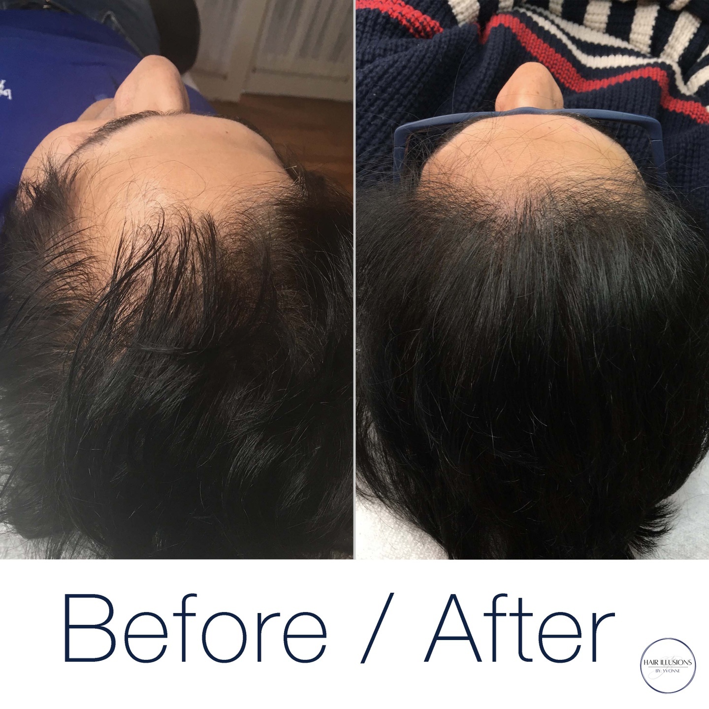 Another beautiful example of SMP working alongside long hair to create the perfect amount of fullness. I would love to help you bring your s