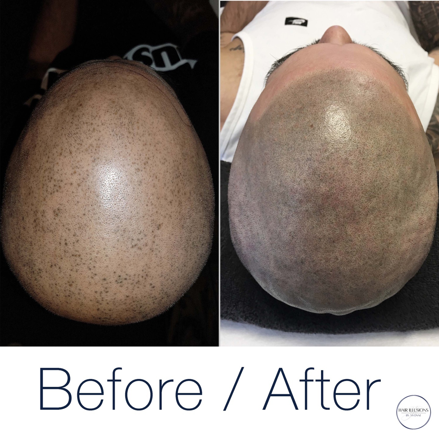 After visiting a nearby technician, this client was left with less than favourable results. It took some touching up, but we were able to bl